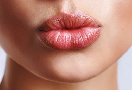 The Pouty Possibilities: Everything You Need to Know About Lip Filler - Nurse Jamie