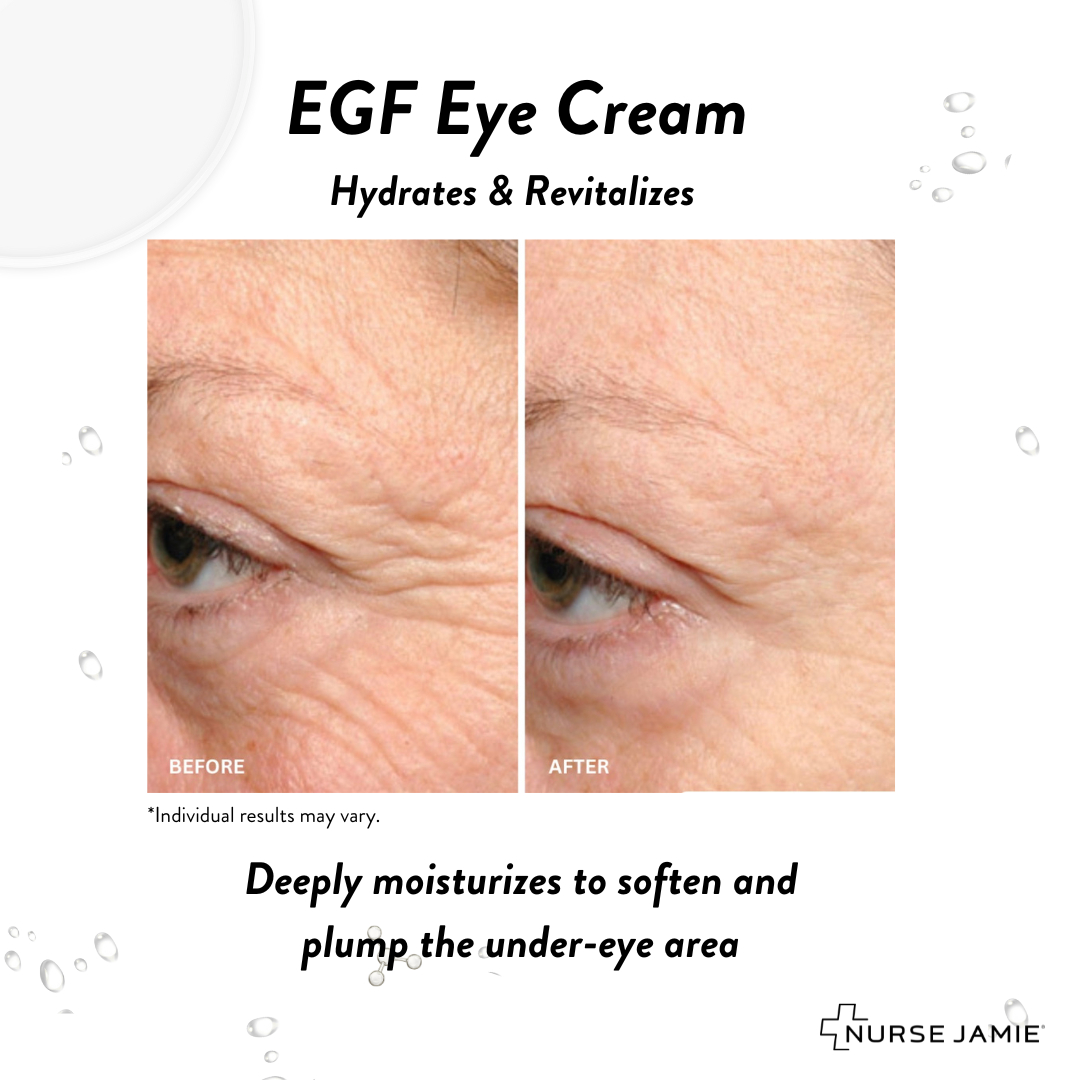 EGF Eye Cream - Nurse Jamie - NJBD3275