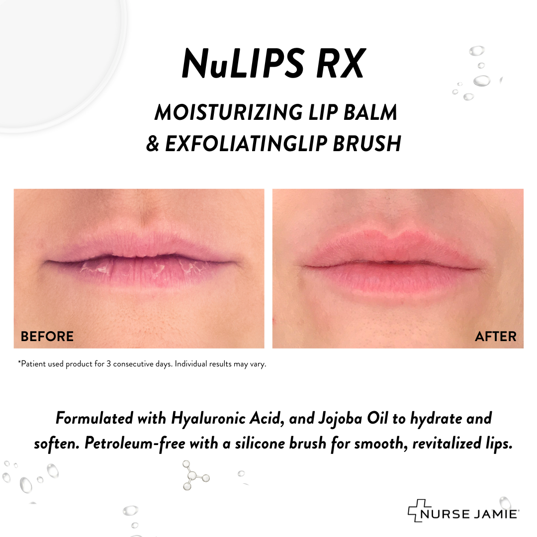 NuLips RX®