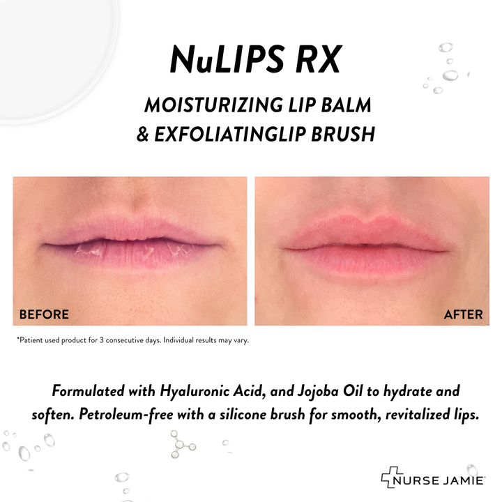 NuLips RX®