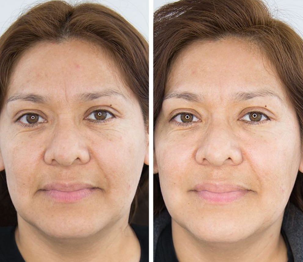 Hydratight™ Mask | Intensive Hydrating & Firming Mask – Nurse Jamie Hydratight™ Mask | Intensive Hydrating & Firming Mask – Nurse Jamie